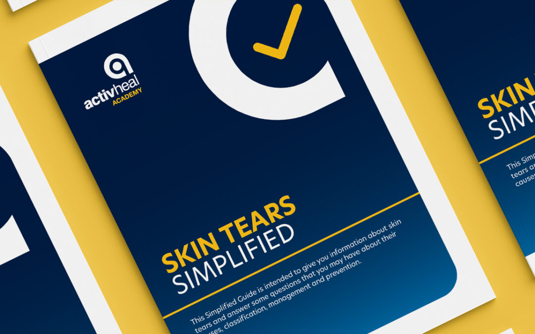 Skin Tears Simplified